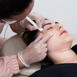 Jato de Plasma Clínica de Estética BH