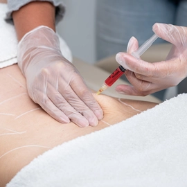 Lipo Enzimática Clínica de Estética BH