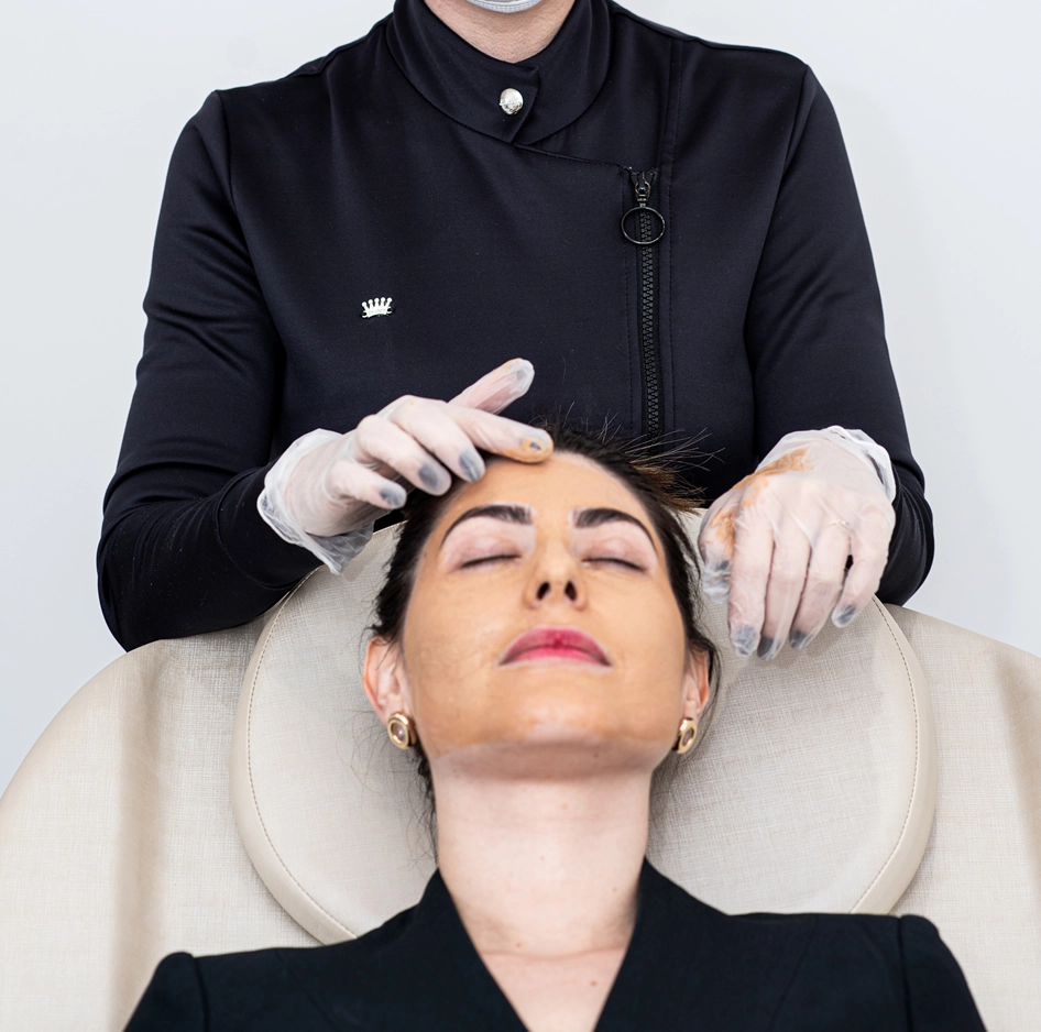 Peeling Químico Clínica de Estética BH