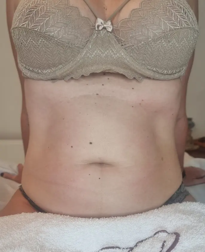 Clínica de Estética BH