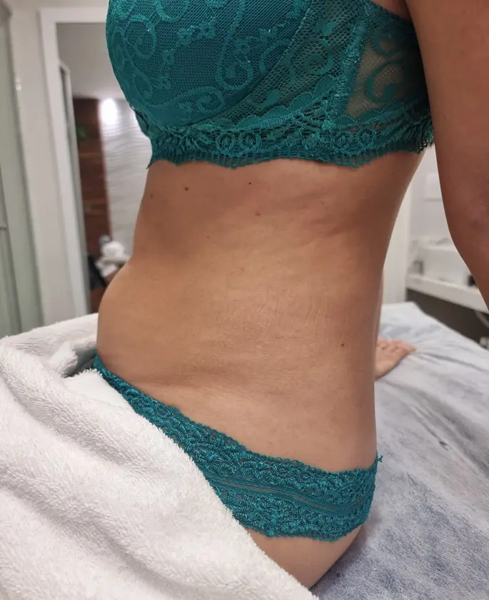 Clínica de Estética BH