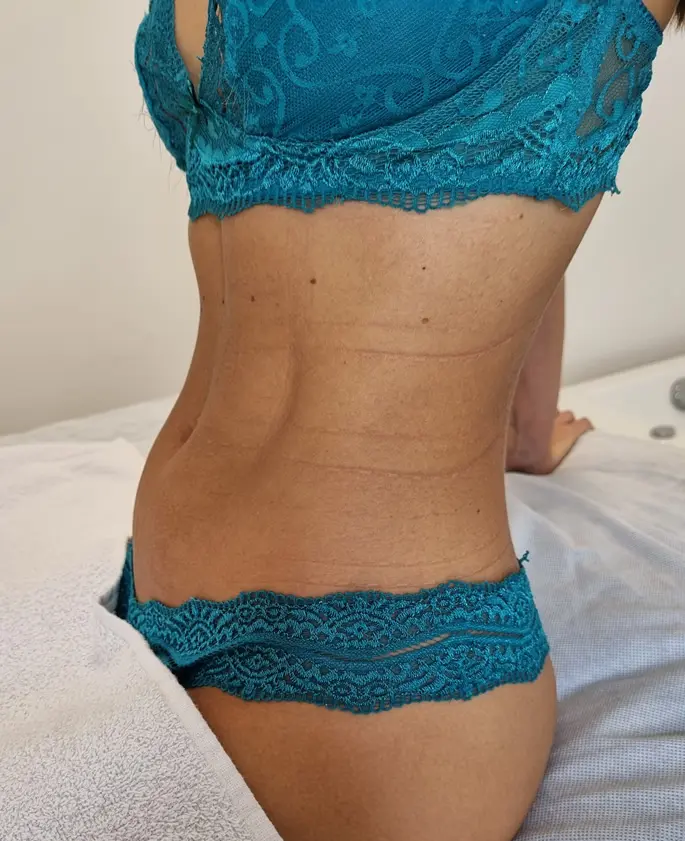 Clínica de Estética BH