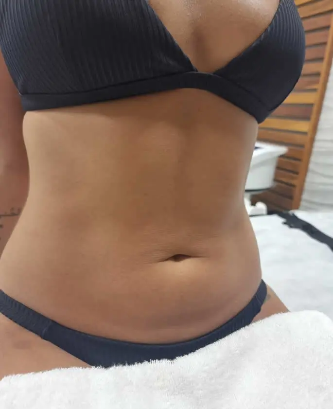 Clínica de Estética BH