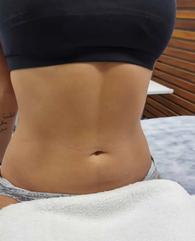 Clínica de Estética BH