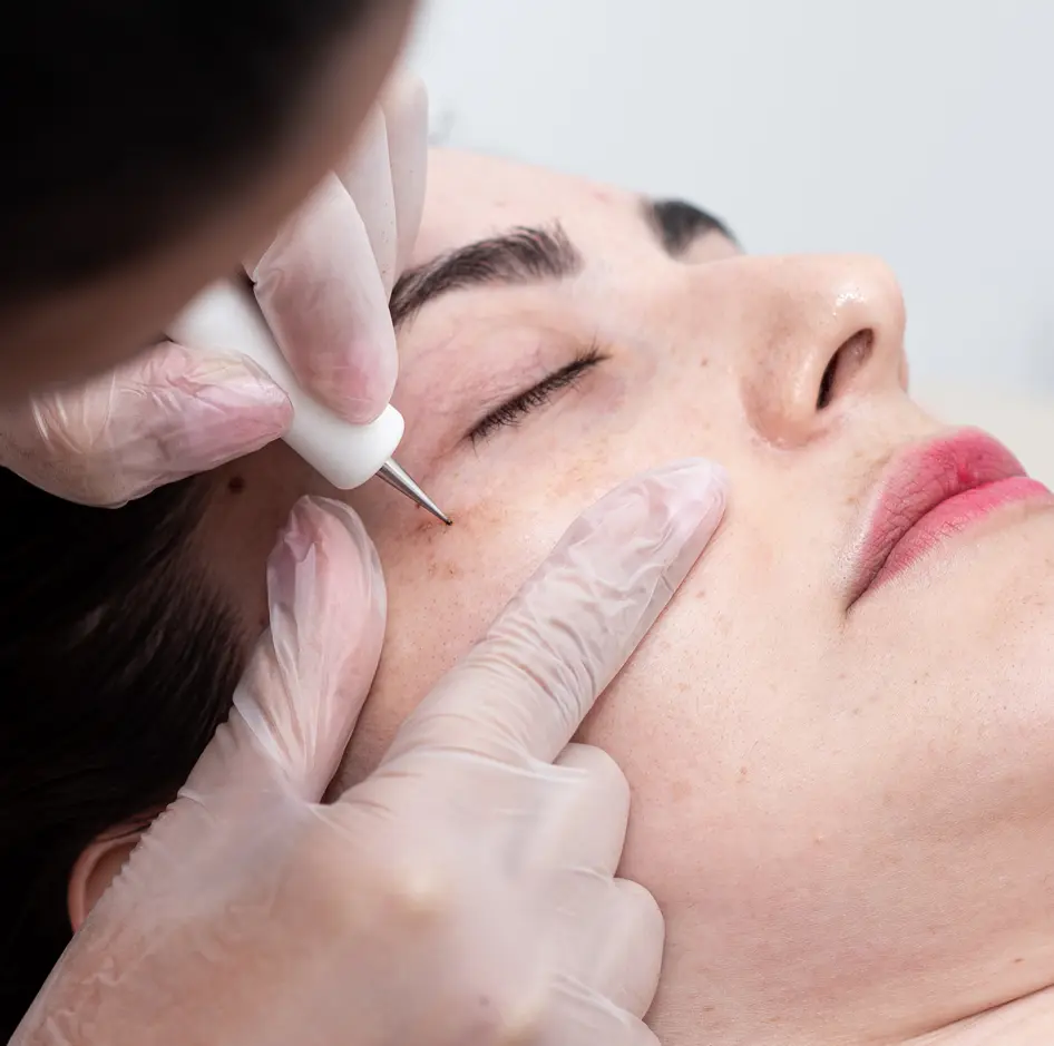 Jato de Plasma Clínica de Estética BH