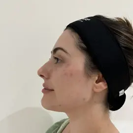 Fios Faciais Clínica de Estética BH