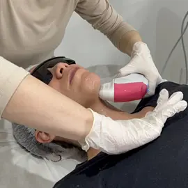 Ultraformer MPT Clínica de Estética BH